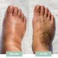 EMS Regenerating Foot Massager (pn)